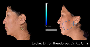 Evoke